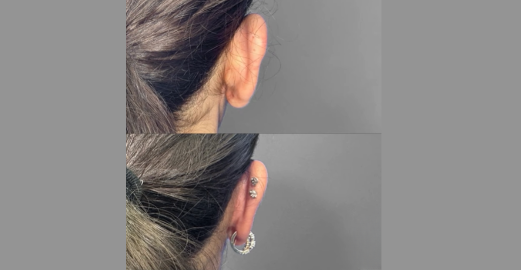 Website B&A (1) Website B&A (1)